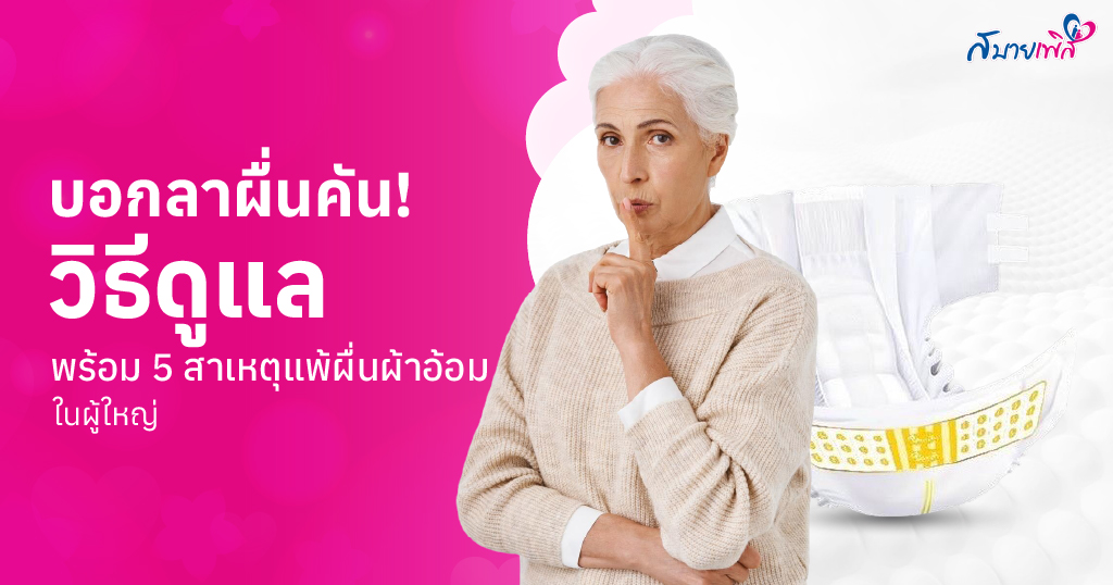 ผื่นผ้าอ้อมผู้ใหญ่