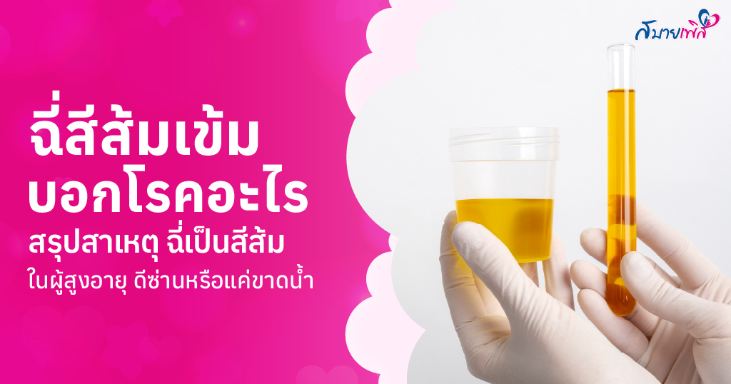 ฉี่สีส้ม
