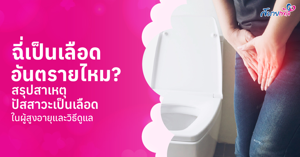 ฉี่เป็นเลือด